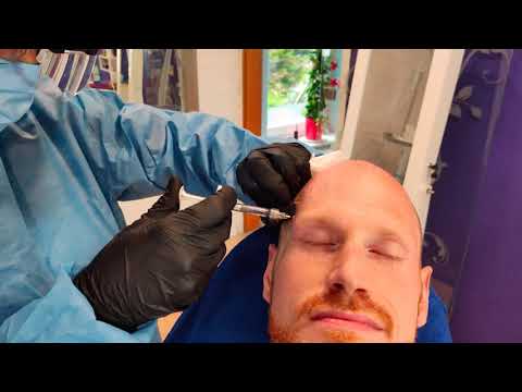 Videovorschau Hyaluron Behandlung