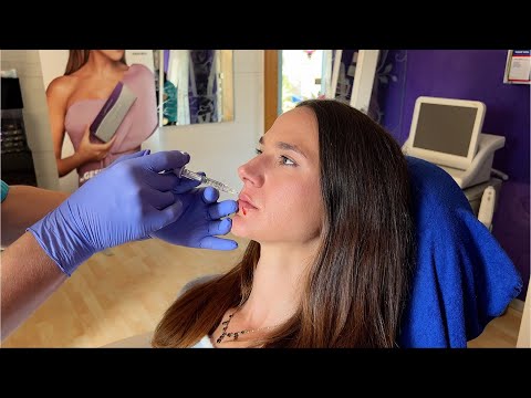 Videovorschau Lippen aufspritzen